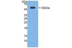 Detection of Recombinant EP3, Human using Polyclonal Antibody to Prostaglandin E Receptor 3 (EP3) (PTGER3 anticorps  (AA 217-390))