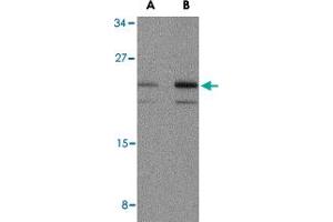 Western blot analysis of IL23A in mouse pancreas tissue lysate with IL23A polyclonal antibody  at (A) 1 and (B) 2 ug/mL . (IL23A anticorps  (N-Term))
