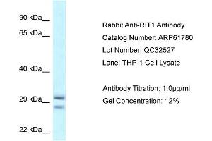 Western Blotting (WB) image for anti-Ras-Like Without CAAX 1 (RIT1) (Middle Region) antibody (ABIN2774323) (RIT1 anticorps  (Middle Region))