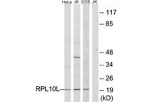 Western blot analysis of extracts from Jurkat/COS7/HeLa cells, using RPL10L Antibody. (RPL10L anticorps  (AA 151-200))
