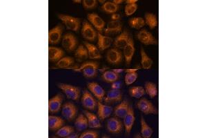Immunofluorescence analysis of HeLa cells using CAMKV antibody (ABIN7266051) at dilution of 1:100.