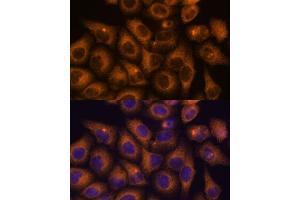 Immunofluorescence analysis of HeLa cells using CAMKV antibody (ABIN7266051) at dilution of 1:100. (CAMKV anticorps  (AA 1-285))