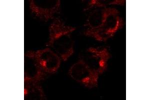 Immunofluorescence (IF) image for anti-RAB1A, Member RAS Oncogene Family (RAB1A) (C-Term) antibody (ABIN1440053)