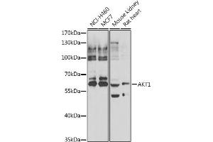 Western blot analysis of extracts of various cell lines, using  antibody (ABIN6133552, ABIN6136735, ABIN6136740 and ABIN6223092). (AKT1 anticorps  (AA 50-150))