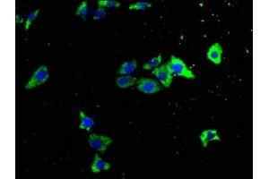 Immunofluorescence staining of HepG2 cells with ABIN7151041 at 1:133, counter-stained with DAPI.