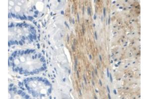 IHC-P analysis of Rat Small intestine Tissue, with DAB staining. (TLR5 anticorps  (AA 325-644))
