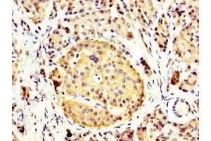 IHC image of ABIN7153687 diluted at 1:400 and staining in paraffin-embedded human pancreatic tissue performed on a Leica BondTM system.