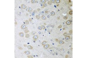 Immunohistochemistry of paraffin-embedded mouse brain using ATAD3A antibody at dilution of 1:100 (40x lens). (ATAD3A anticorps)