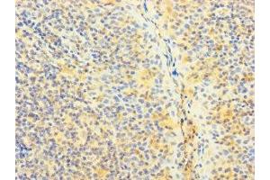 Immunohistochemistry of paraffin-embedded human tonsil tissue using ABIN7170373 at dilution of 1:100 (SNX22 anticorps  (AA 1-120))