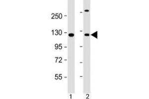 Western blot testing of human 1) A431 and 2) HeLa cell lysate with INTS6 antibody at 1:2000. (INTS6 anticorps  (AA 135-167))