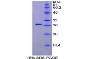 SDS-PAGE analysis of Rat XRCC6 Protein. (XRCC6 Protéine)