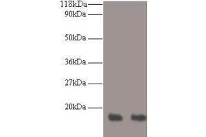 Western blot All lanes: RPA3 antibody at 2 μg/mL Lane 1: LO2 whole cell lysate Lane 2: HepG2 whole cell lysate Secondary Goat polyclonal to rabbit IgG at 1/10000 dilution Predicted band size: 14 kDa Observed band size: 14 kDa (RPA3 anticorps  (AA 1-119))