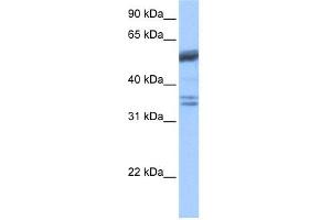 WB Suggested Anti-COIL Antibody Titration: 0. (Coilin anticorps  (C-Term))