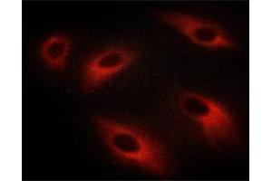 ABIN6267613 staining C6 cells treated with λ phosphatase by ICC/IF. (PKC zeta anticorps  (pThr410))