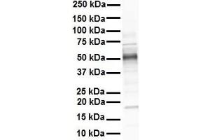 WB Suggested Anti-GREB1 antibody Titration: 1 ug/mL Sample Type: Human heart (GREB1 anticorps  (N-Term))