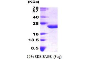 SDS-PAGE (SDS) image for Interleukin 6 (IL6) (AA 30-212) protein (His tag) (ABIN666780) (IL-6 Protein (AA 30-212) (His tag))