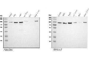 Western blot analysis of STIM1 using anti-STIM1 antibody (ABIN3043940), Left) and anti-STIM1 antibody (ABIN7606404), Right). (STIM1 anticorps  (N-Term))