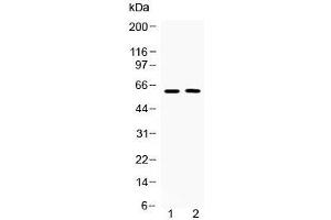 Western blot testing of human 1) COLO320 and 2) MCF7 cell lysate with Tubby antibody at 0. (TUB anticorps  (AA 395-429))