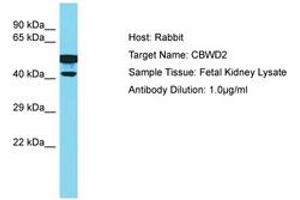 Image no. 1 for anti-COBW Domain Containing 2 (CBWD2) (AA 278-327) antibody (ABIN6750552) (CBWD2 anticorps  (AA 278-327))
