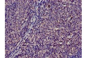 Immunohistochemistry of paraffin-embedded human lymph node tissue using ABIN7172131 at dilution of 1:100 (TMSB4X anticorps  (AA 6-44))