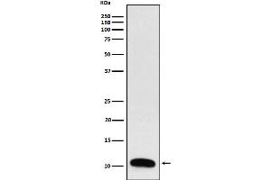 Western blot analysis of Trefoil Factor 3 expression in Human colon cancer lysate.