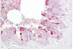 Anti-EBP1 antibody IHC staining of human lung, respiratory epithelium. (PA2G4 anticorps  (AA 301-350))