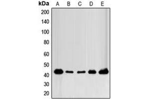 Western blot analysis of FOP expression in MCF7 (A), MDAMB231 (B), MDAMB435 (C), mouse brain (D), rat brain (E) whole cell lysates. (FGFR1OP anticorps  (C-Term))