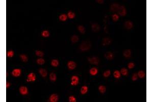 ABIN6266831 staining HeLa by IF/ICC. (ZNF225 anticorps  (C-Term))