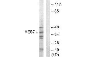 Western blot analysis of extracts from NIH-3T3 cells, using HEXIM1 Antibody. (HEXIM1 anticorps  (AA 181-230))