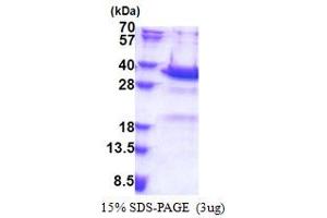 SDS-PAGE (SDS) image for Synaptotagmin V (SYT5) (AA 109-386) protein (His tag) (ABIN5853322)