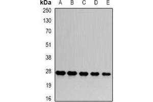 Western blot analysis of PSMA6 expression in HepG2 (A), Hela (B), mouse skeletal muscle (C), PC12 (D), COS7 (E) whole cell lysates. (PSMA6 anticorps)