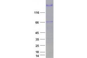 Validation with Western Blot