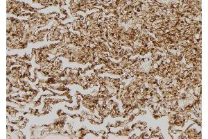 ABIN6269335 at 1/100 staining Human lung tissue by IHC-P.