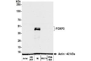 Western Blotting (WB) image for anti-Forkhead Box P3 (FOXP3) (AA 275-325) antibody (ABIN7795682)