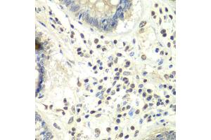 Immunohistochemistry of paraffin-embedded human colon using PRMT5 antibody. (PRMT5 anticorps)