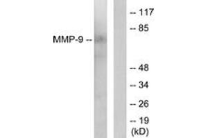 Western blot analysis of extracts from HepG2 cells, using MMP-9 Antibody. (MMP 9 anticorps  (AA 651-700))