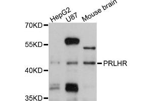 Western blot analysis of extracts of various cells, using PRLHR antibody. (PRLHR anticorps)