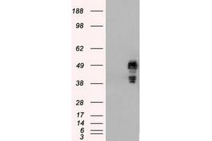 HEK293T cells were transfected with the pCMV6-ENTRY control (Left lane) or pCMV6-ENTRY SSB (Right lane) cDNA for 48 hrs and lysed. (SSB anticorps)