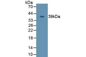 Detection of Recombinant ND5, Human using Polyclonal Antibody to NADH Dehydrogenase 5 (ND5) (MT-ND5 anticorps  (AA 522-603))