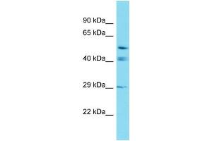 Western Blotting (WB) image for anti-Glutaredoxin, Cysteine Rich 2 (GRXCR2) (C-Term) antibody (ABIN2791568) (GRXCR2 anticorps  (C-Term))