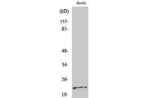 Western Blotting (WB) image for anti-Parkinson Protein 7 (PARK7) (Internal Region) antibody (ABIN3176773) (PARK7/DJ1 anticorps  (Internal Region))