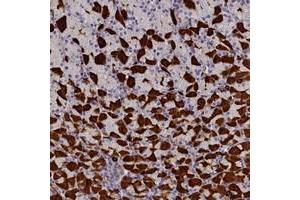 Immunohistochemical staining of human stomach with RTTN polyclonal antibody  shows strong cytoplasmic positivity in gastric parietal cells at 1:200-1:500 dilution. (Rotatin (RTTN) anticorps)