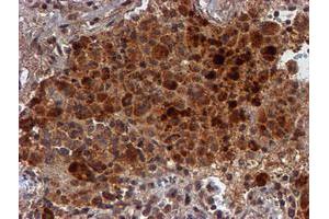 Image no. 8 for anti-Histidyl-tRNA Synthetase 2, Mitochondrial (Putative) (HARS2) antibody (ABIN1498584)