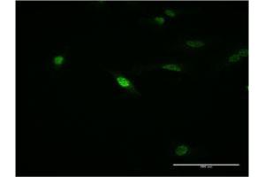 Immunofluorescence of monoclonal antibody to MEOX1 on HeLa cell. (MEOX1 anticorps  (AA 82-170))