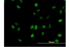 Image no. 3 for anti-Mediator Complex Subunit 21 (MED21) (AA 1-145) antibody (ABIN599079) (MED21 anticorps  (AA 1-145))