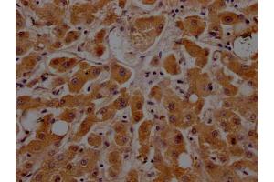 IHC image of ABIN7127343 diluted at 1:100 and staining in paraffin-embedded human liver tissue performed on a Leica BondTM system. (Recombinant APOC3 anticorps)