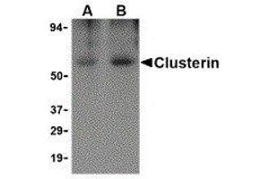 Western Blotting (WB) image for anti-Clusterin (CLU) antibody (ABIN2473012) (Clusterin anticorps)