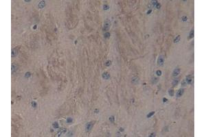 Detection of ADAMTS2 in Mouse Cerebrum Tissue using Polyclonal Antibody to A Disintegrin And Metalloproteinase With Thrombospondin 2 (ADAMTS2) (Adamts2 anticorps  (AA 855-1030))
