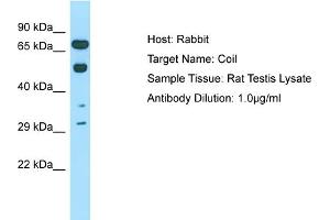 Host: Rabbit Target Name: COIL Sample Tissue: Rat Testis Antibody Dilution: 1ug/ml (Coilin anticorps  (C-Term))