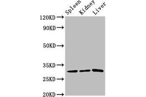 Western Blot Positive WB detected in: Rat spleen tissue, Rat kidney tissue, Rat liver tissue All lanes: CD27 antibody at 3. (CD27 anticorps  (AA 20-191))
